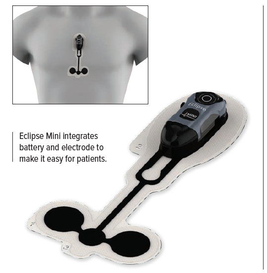 Eclipse Mini integrates battery and electrode to make it easy for patients