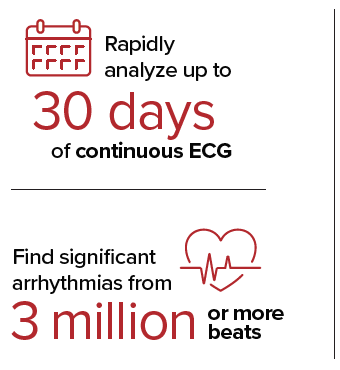 Rapidly analyze up to 30 days of continuous ECG