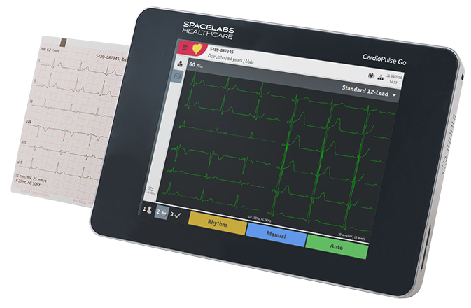 CardioPulse Go resting ECG