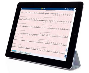 Resting ECG | Spacelabs Healthcare