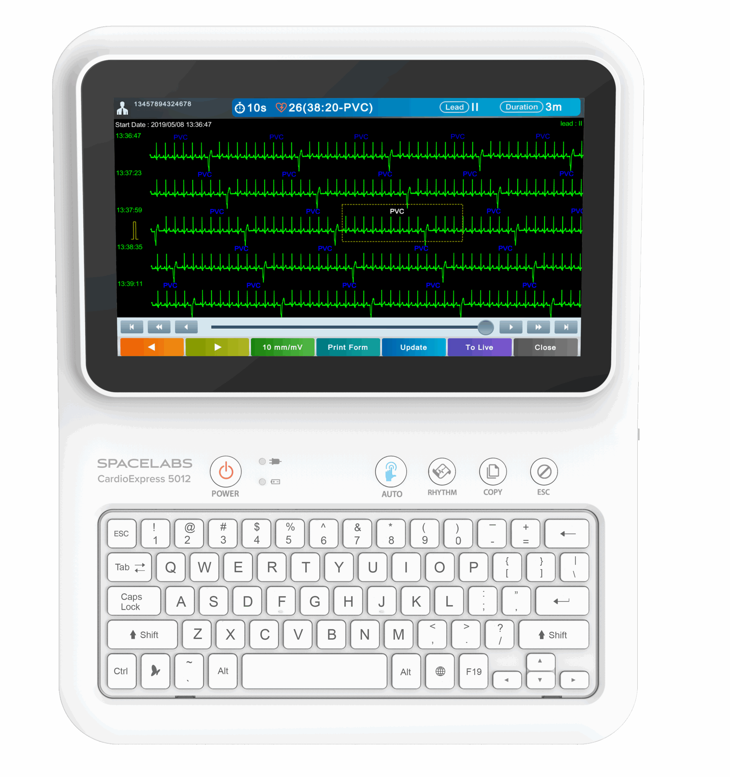 CardioExpress 5012 - front view - green ECG-MERGED