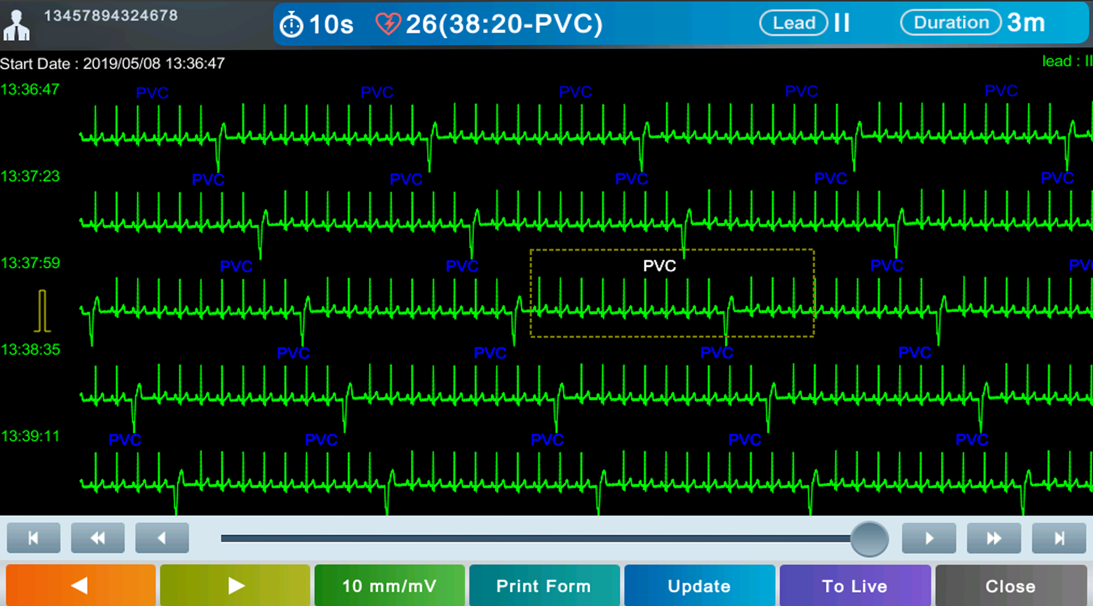 Cardio Express Screenshot 1